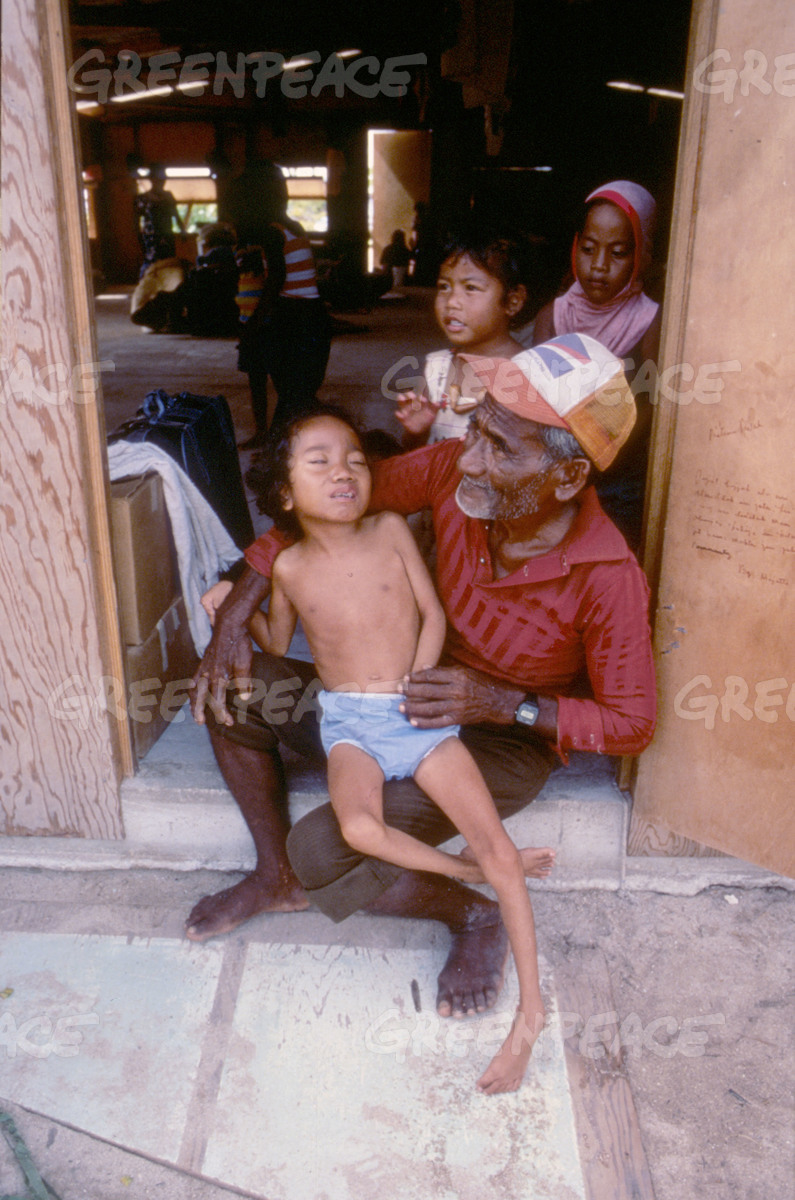 Girl with Birth Defects in Rongelap. © Greenpeace / Fernando Pereira Girl with Birth Defects in Rongelap. © Greenpeace / Fernando Pereira